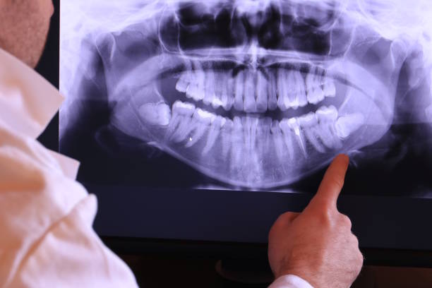 Best Emergency Dental Extractions in Hermitage, PA